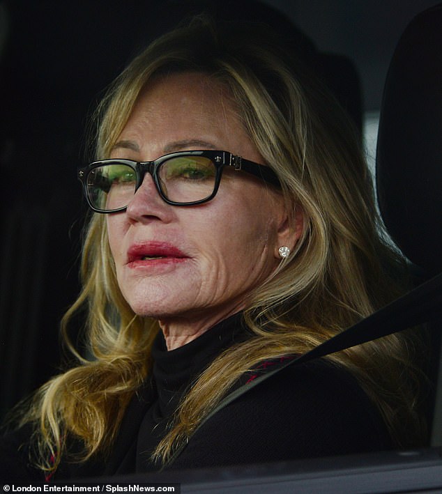Ouch!  Oscar nominee Melanie Griffith stepped out with a large new scar on the left side of her face while out in West Hollywood, CA on Friday afternoon.